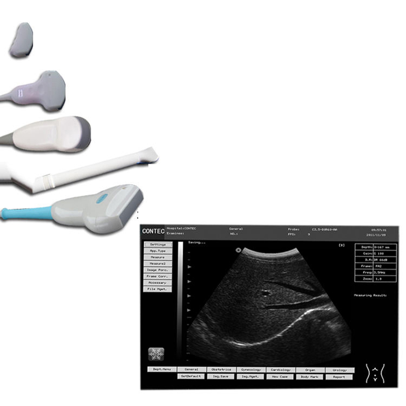 Sistema de diagnóstico por ultrassom veterinário CMS600P2VET