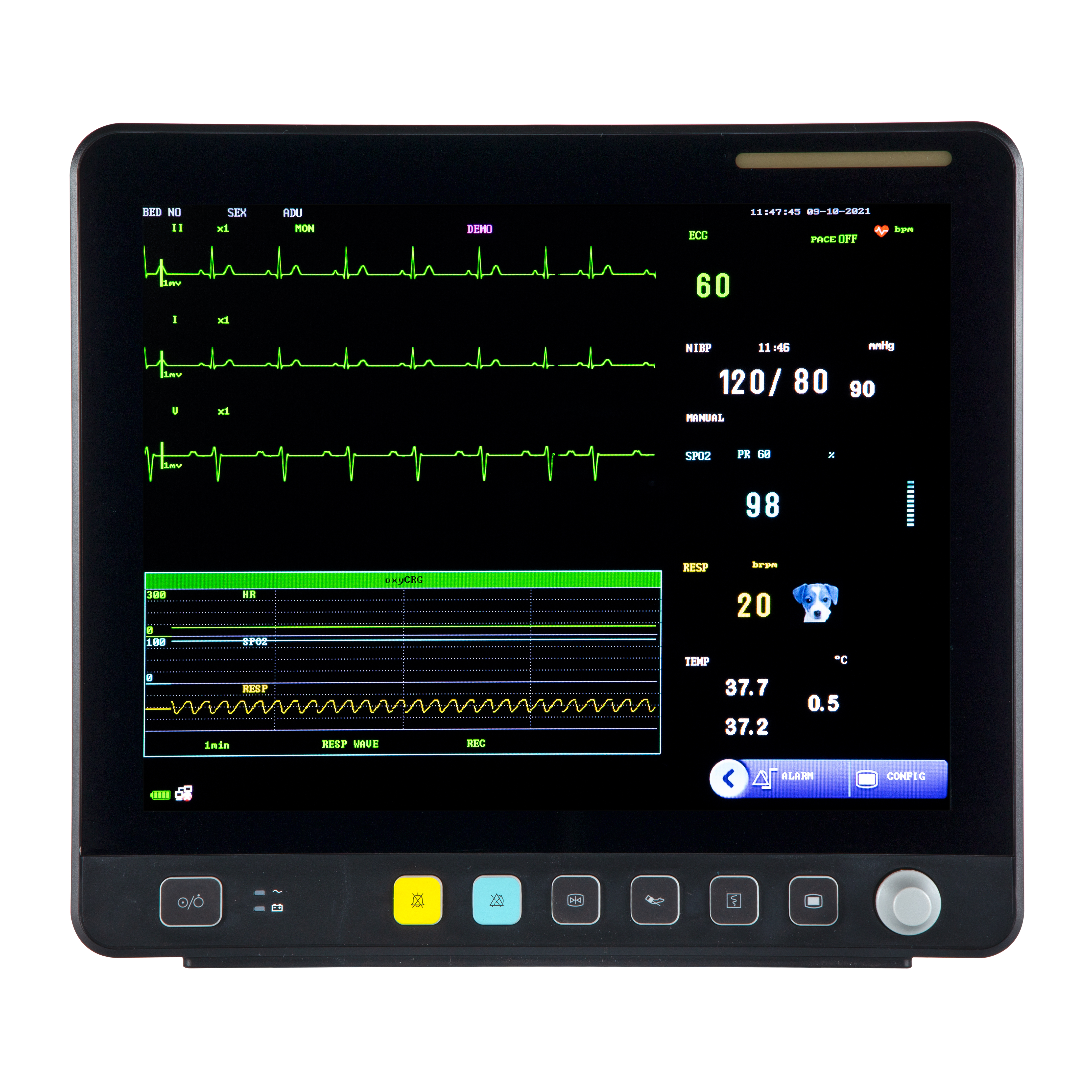 Monitor veterinário de ECG multiparâmetro com tela de toque veterinária VE15