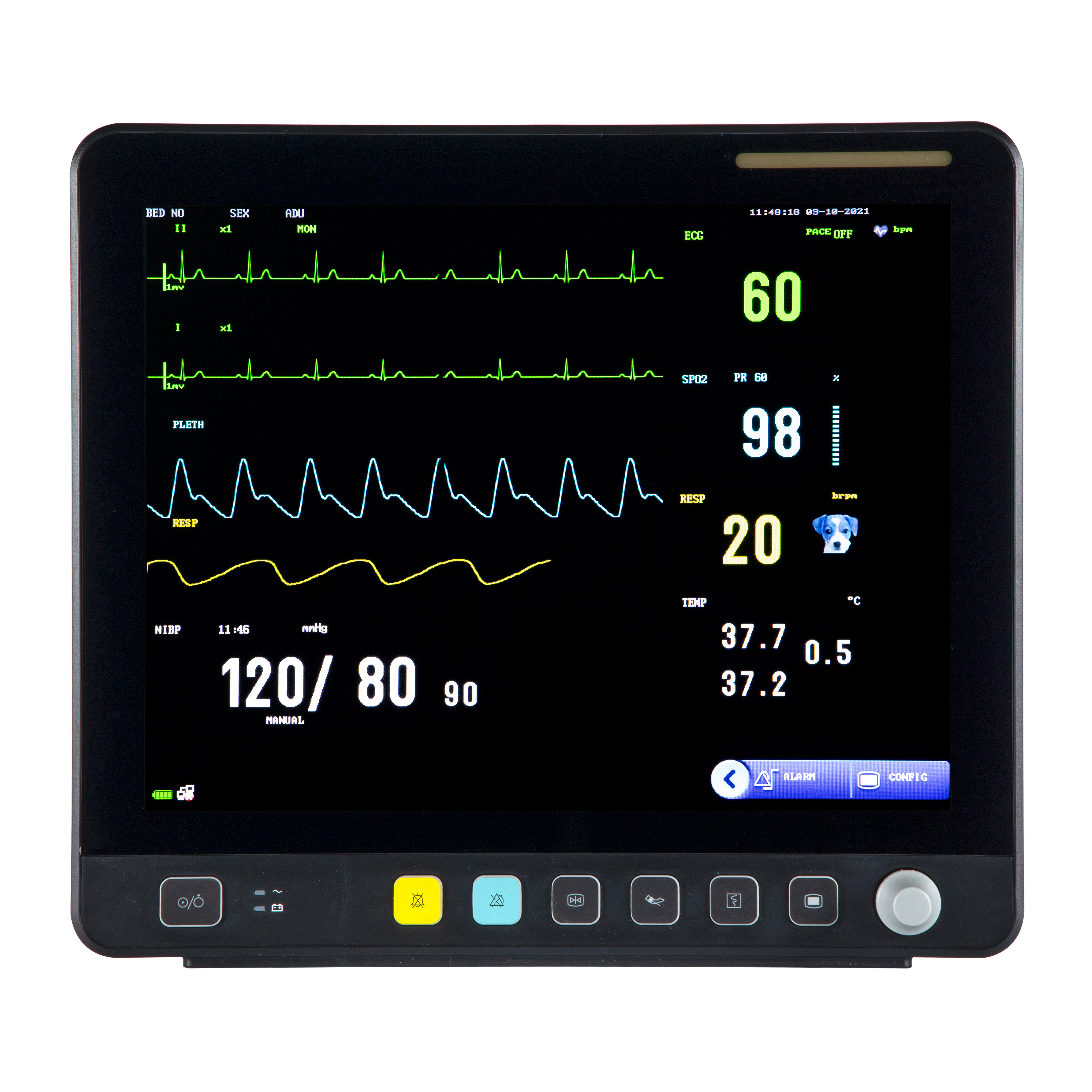 Monitor veterinário de ECG multiparâmetro com tela de toque veterinária VE15